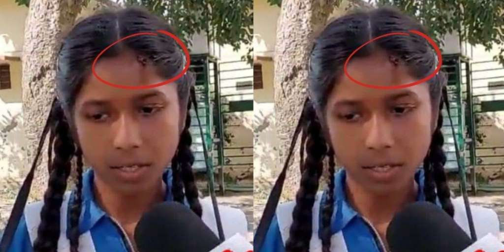 उत्तराखंडः शिक्षक ने डस्टर मारकर छात्रा का सिर फोड़ा, बाल-बाल बची आंख…
